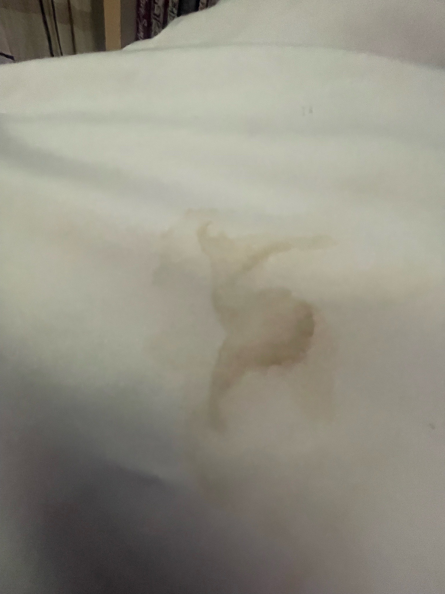 Inconclusive (Likely non-biological stain)