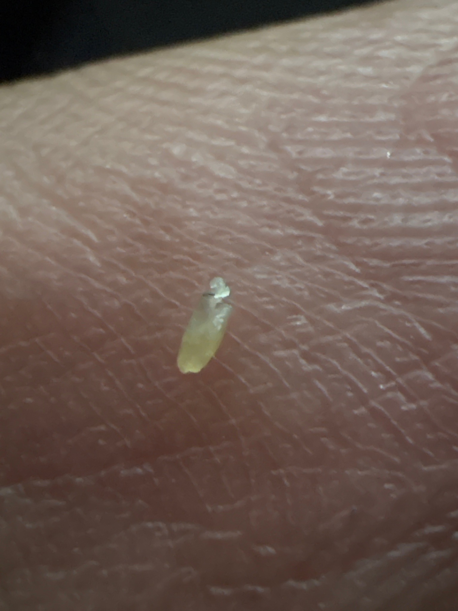 Leafhopper nymph