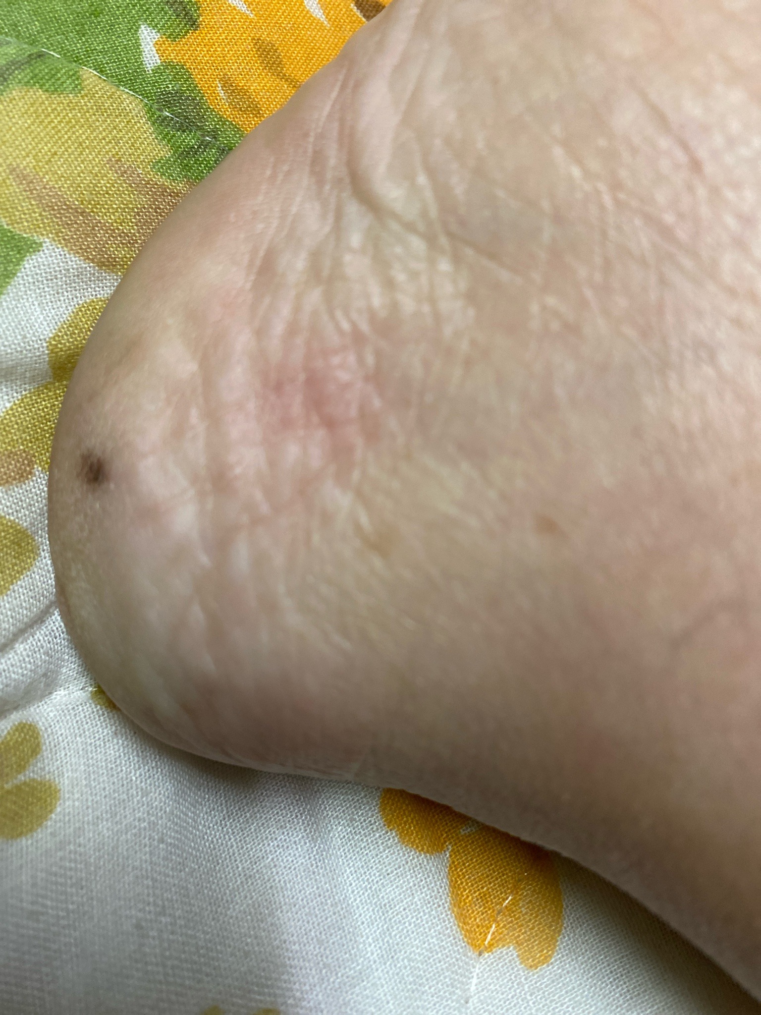 Likely a small tick (possibly a seed tick)