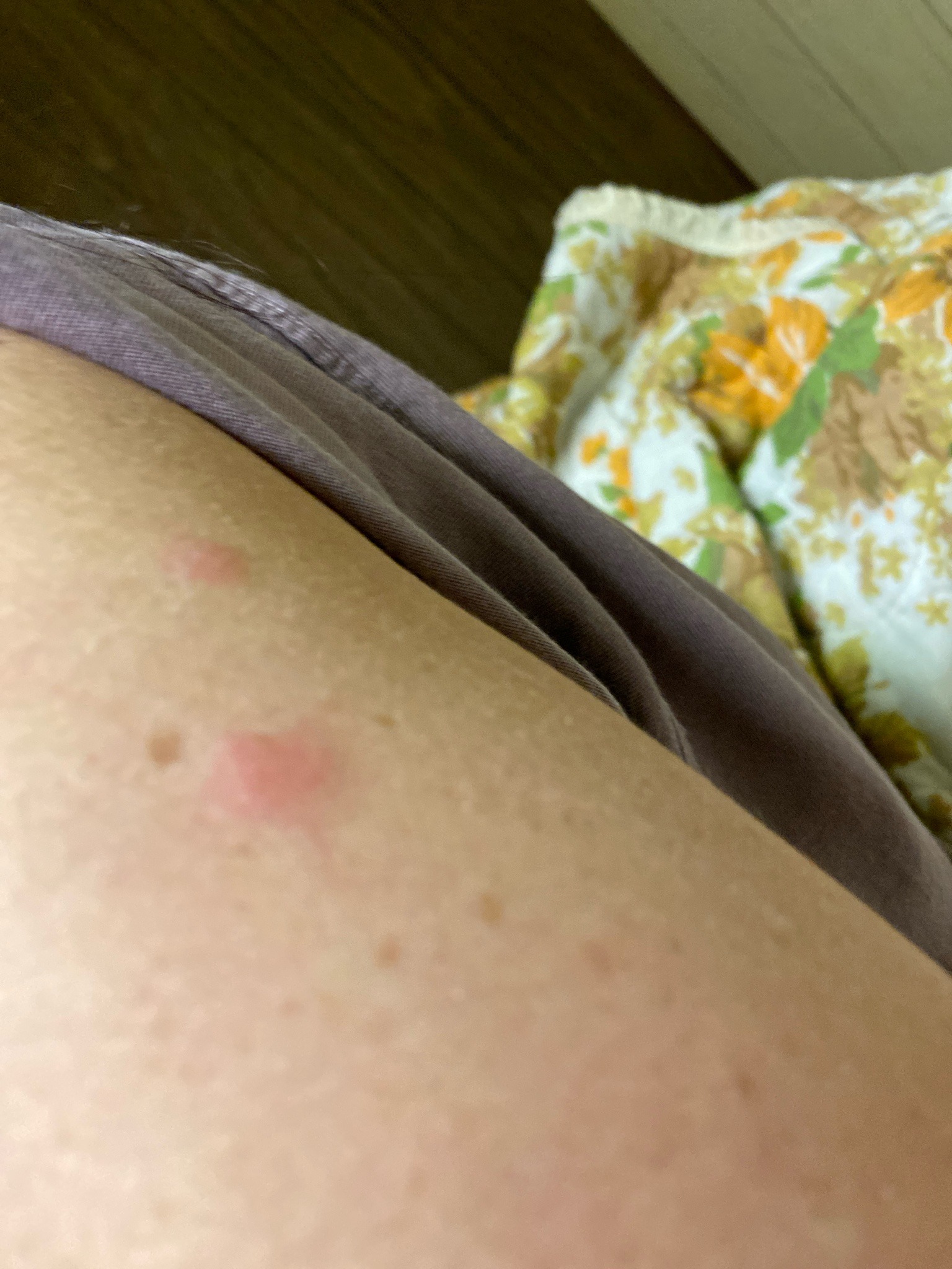 Likely bed bug (based on the clustered itchy bites; insect not visible)