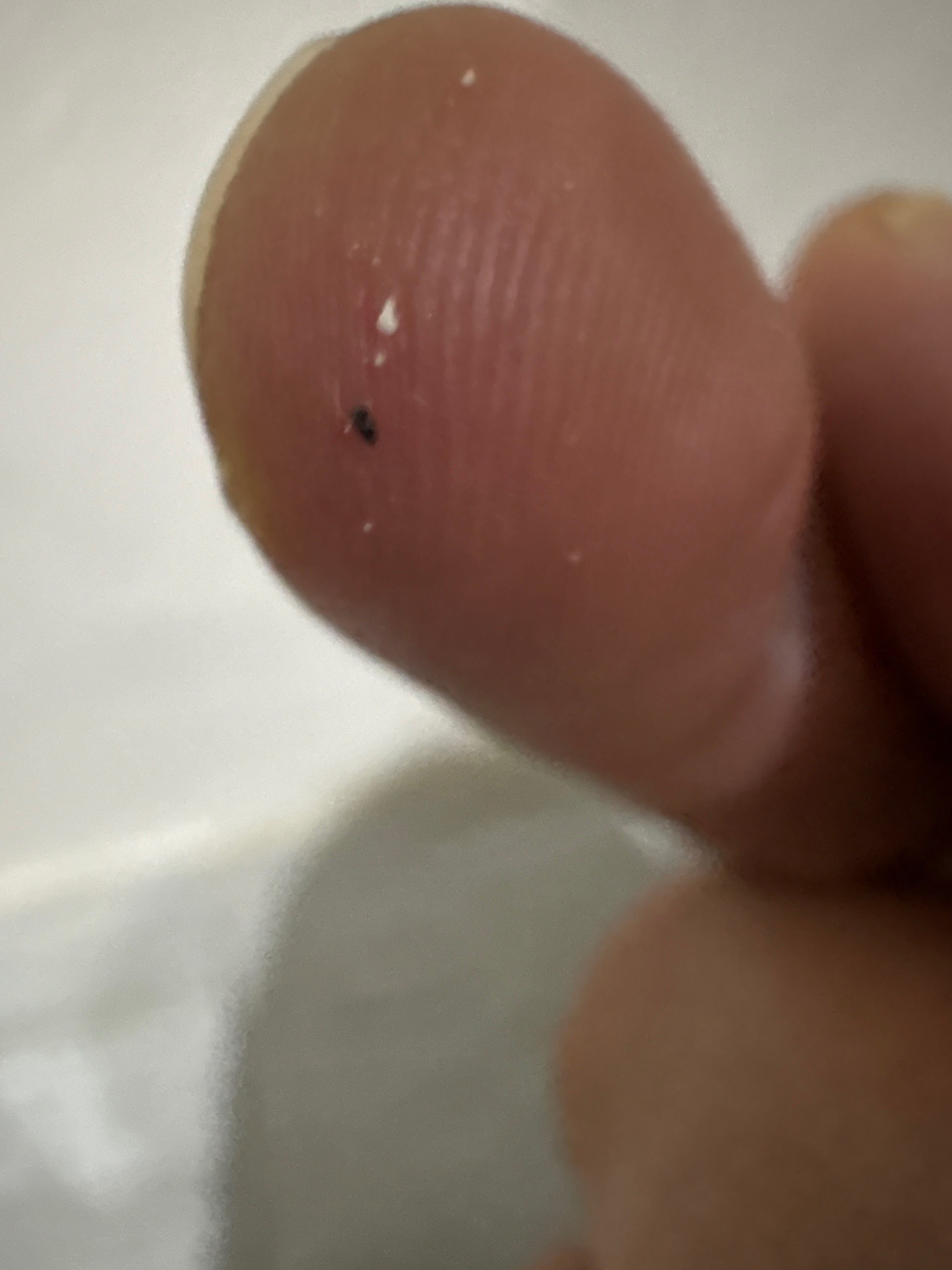 Likely flea (photo too indistinct for certainty)