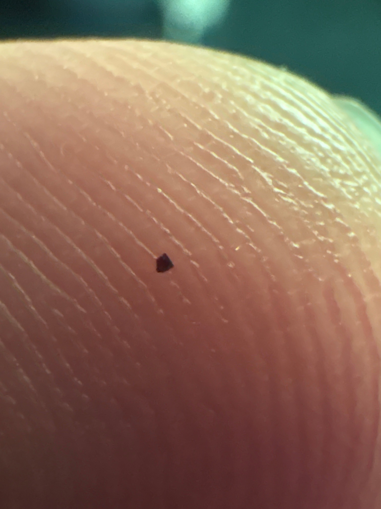 Likely tick larva (“seed tick”)