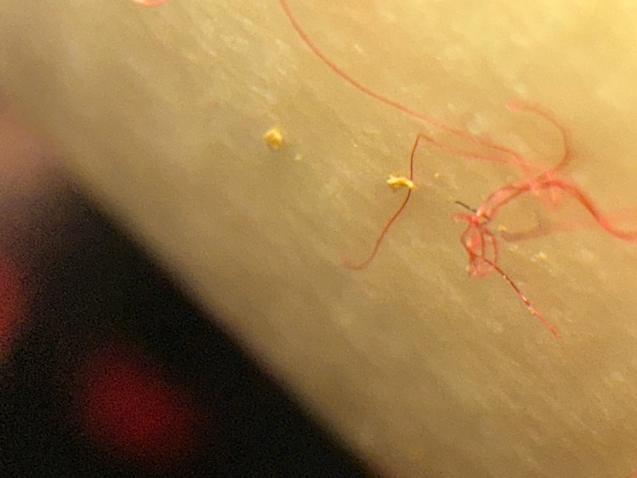 Lint or Synthetic Fiber