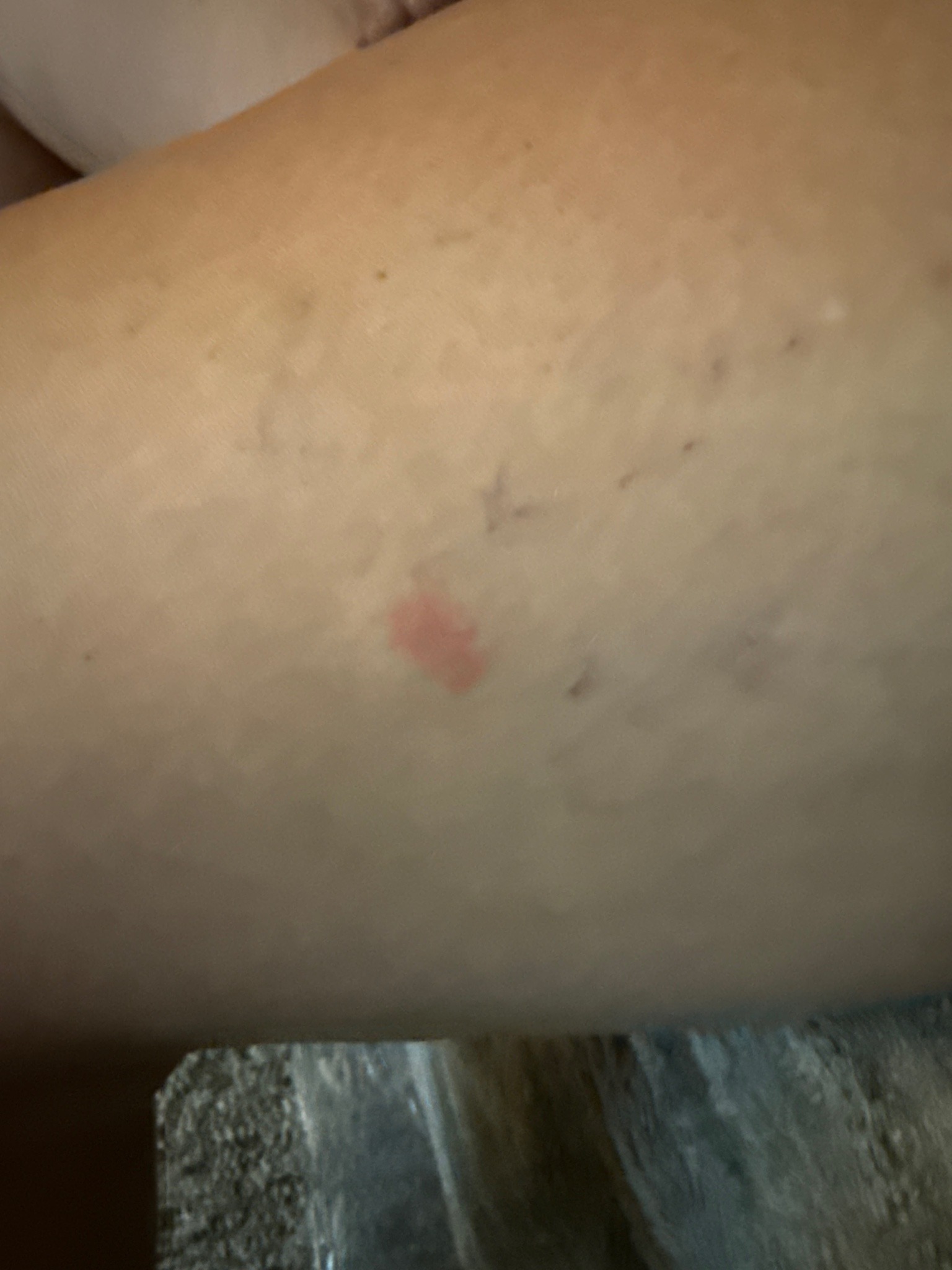 N/A (No insect visible)