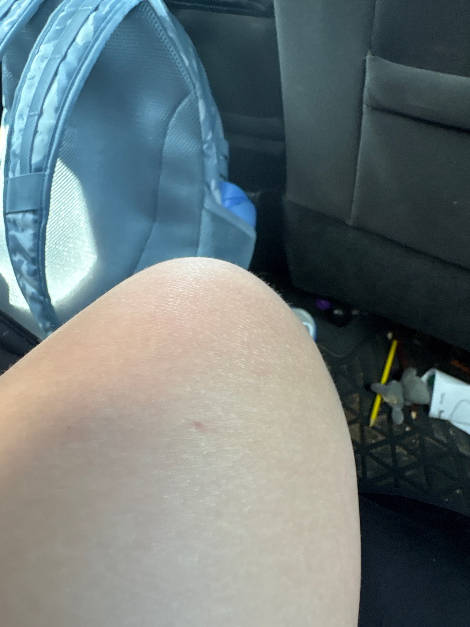 No insect visible