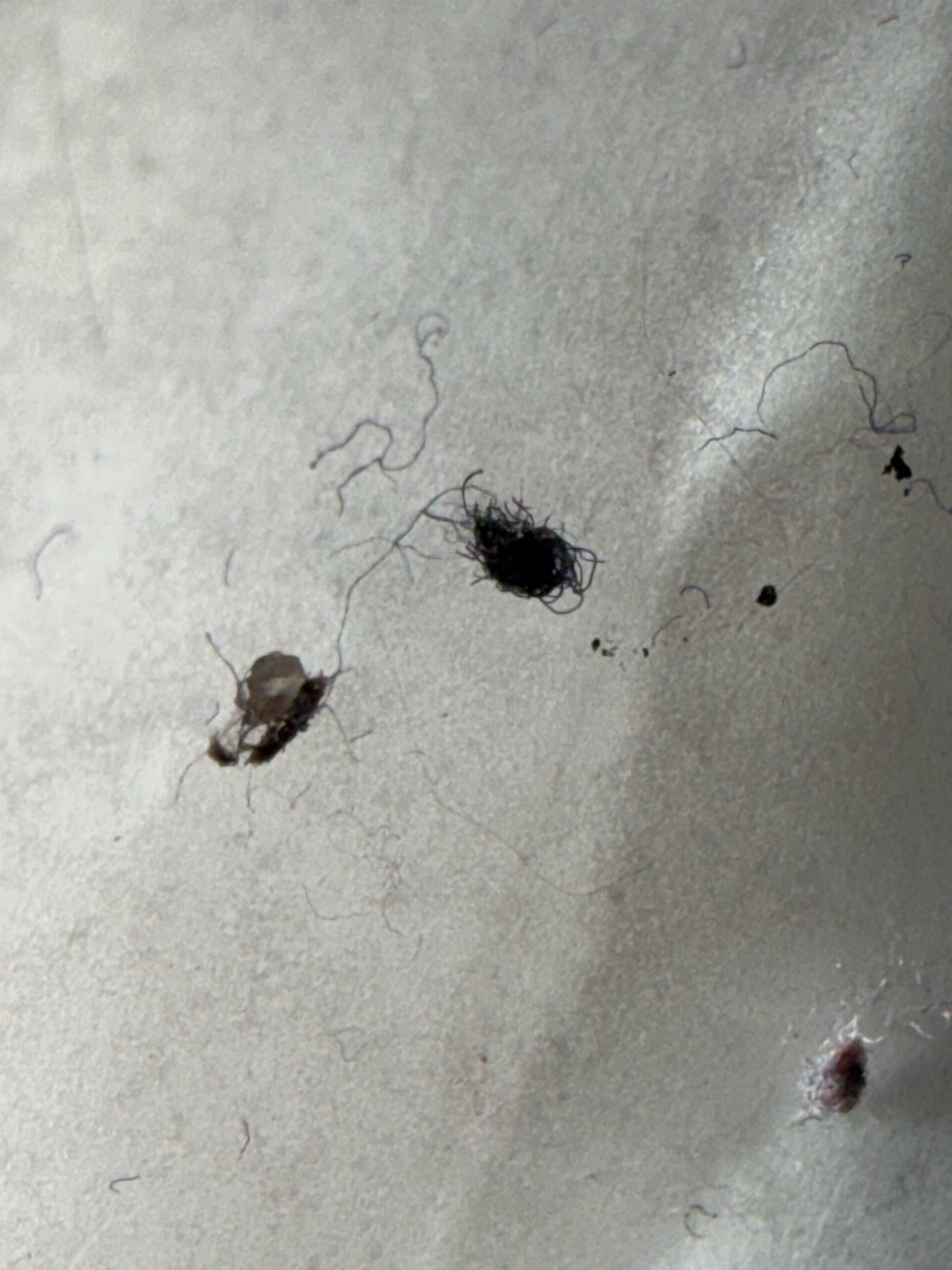 None (Fabric / Lint / Debris)