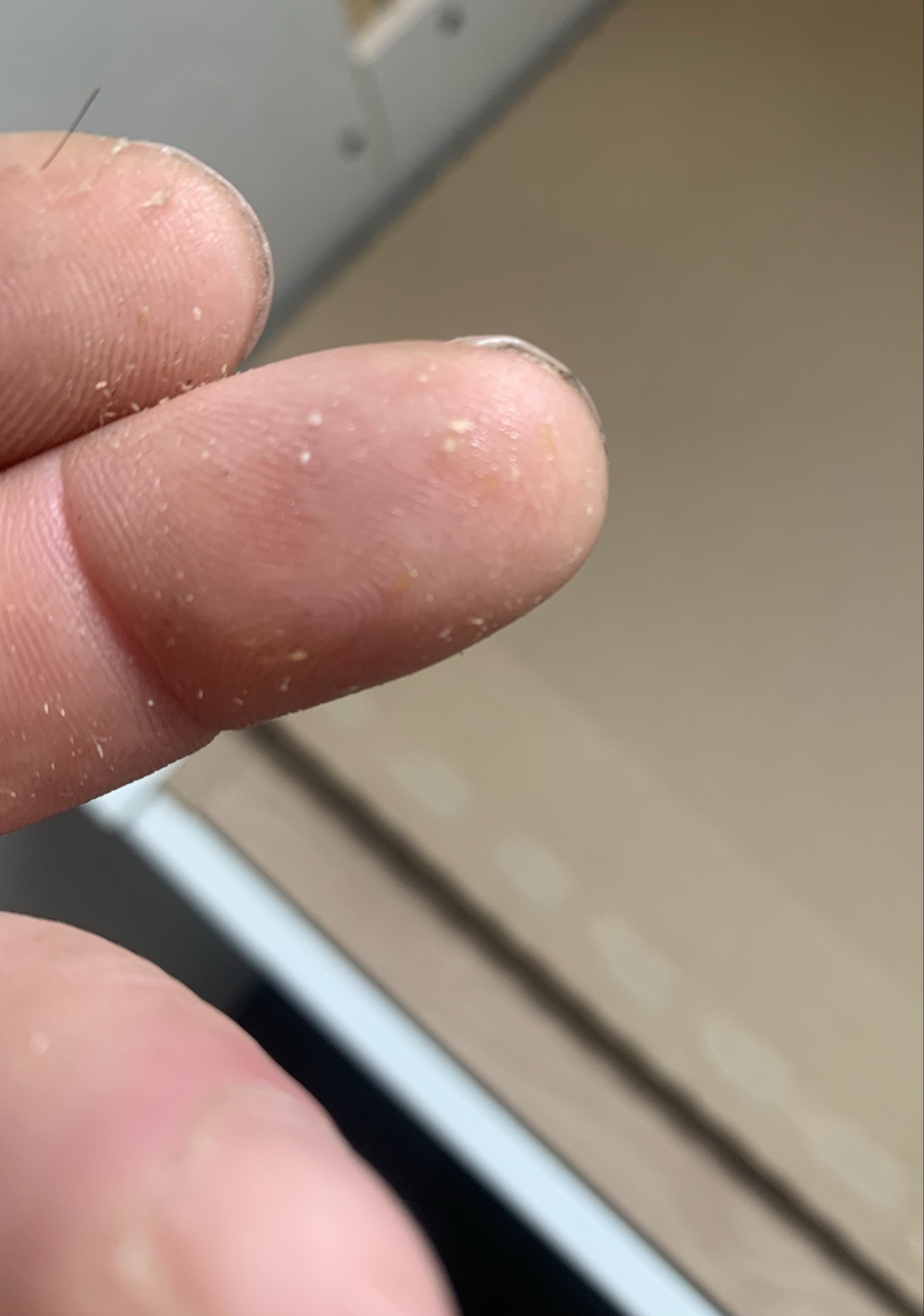 Not identifiable from the image