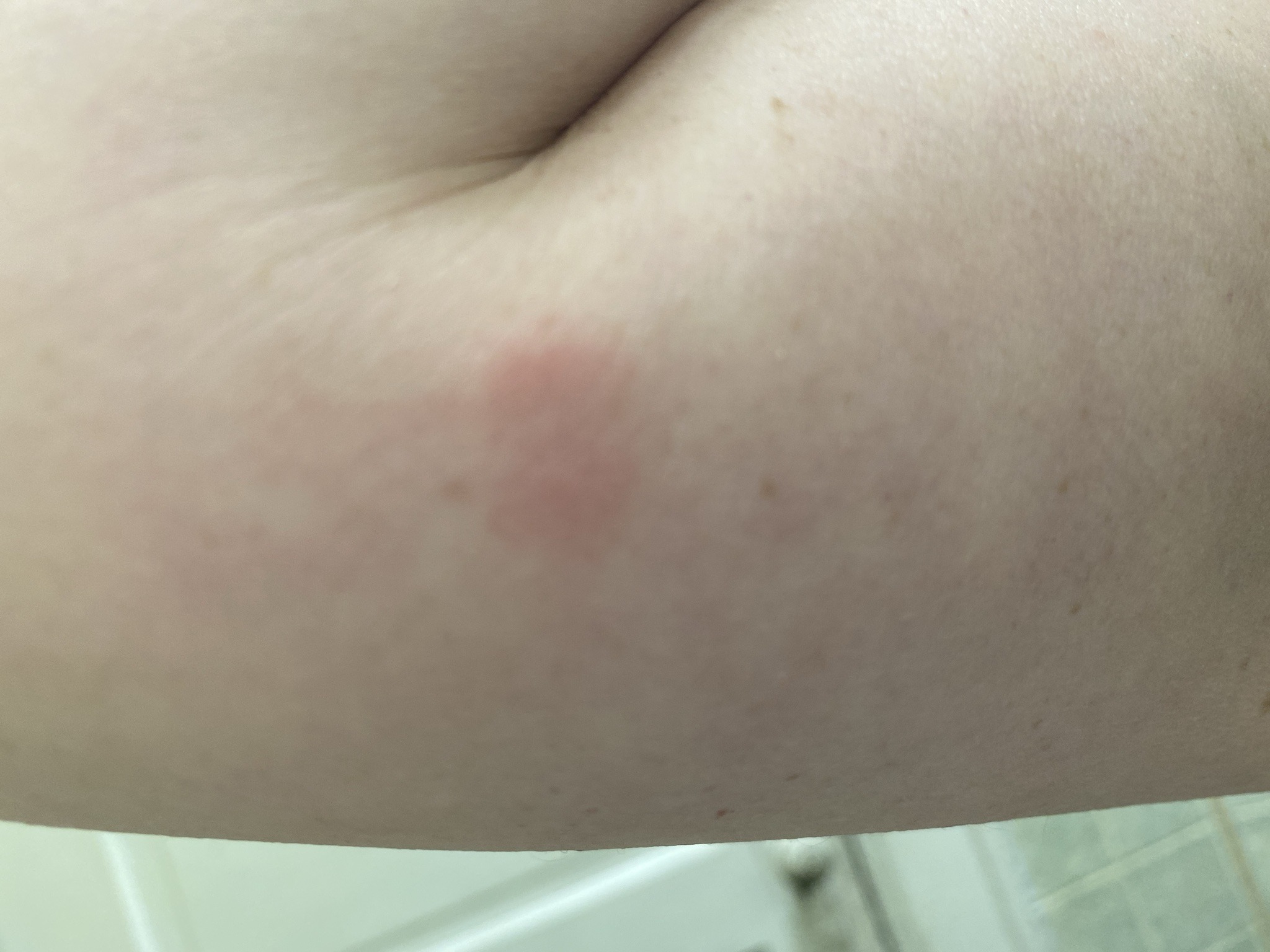 Not identifiable from the image