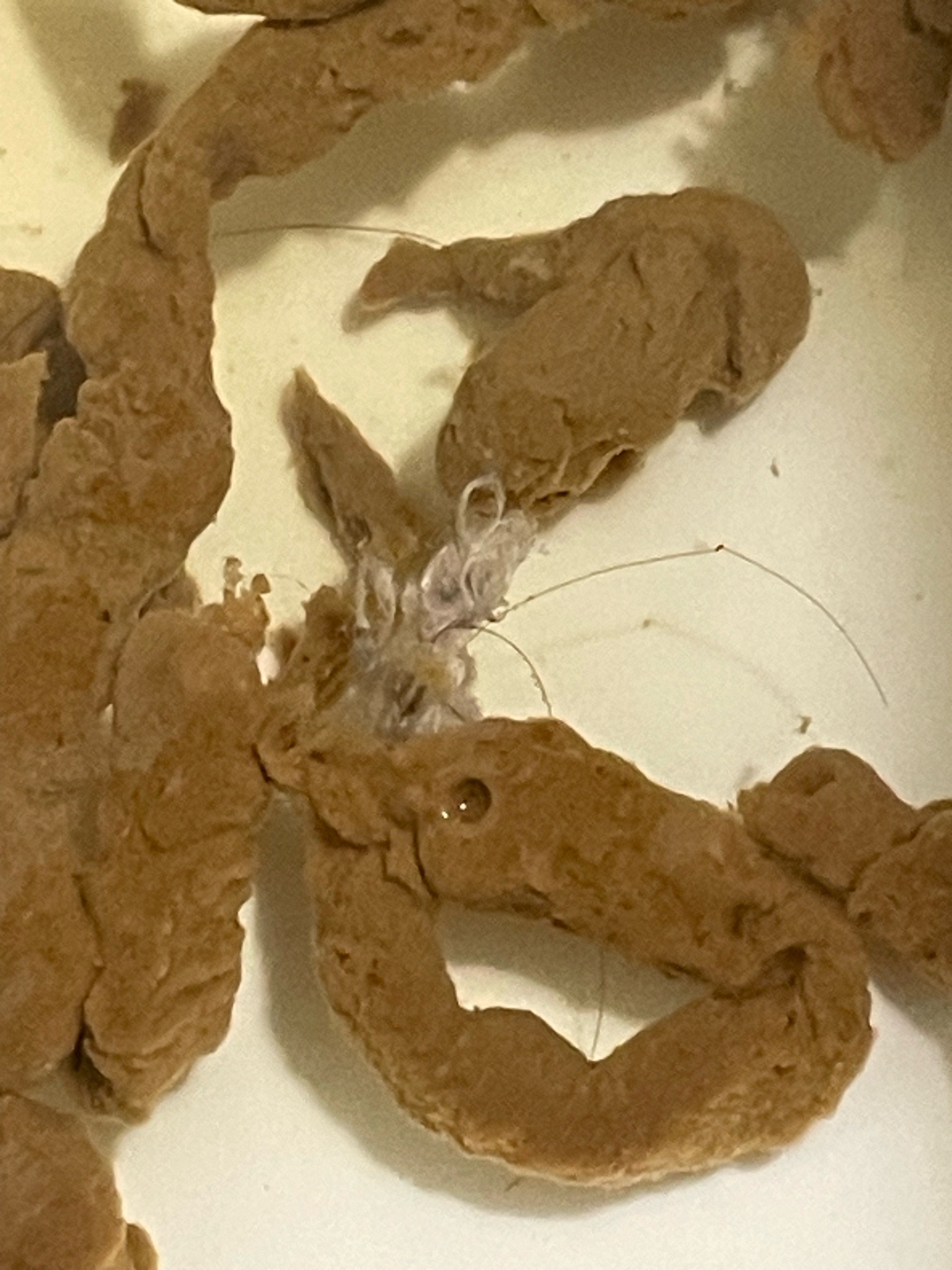 Pinworm