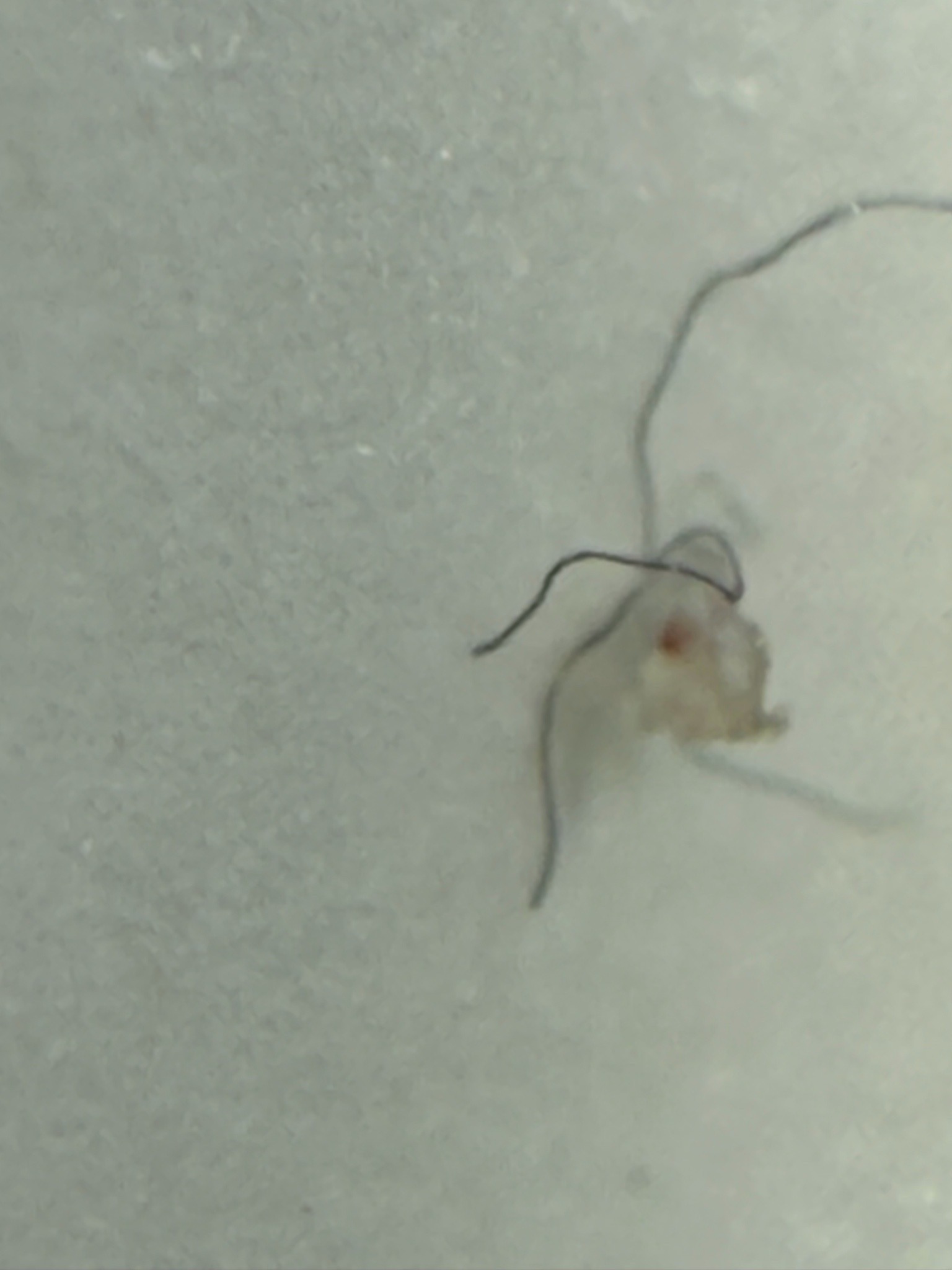 Potential parasite remains (needs professional diagnosis)