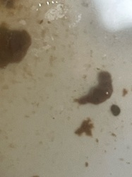 Springtail (Collembola)
