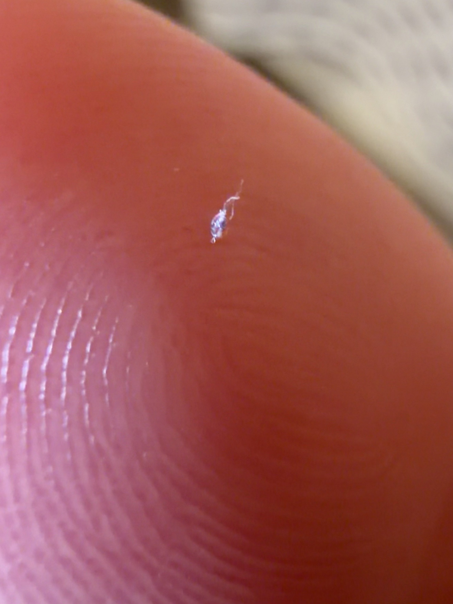 Springtail (likely globular springtail)