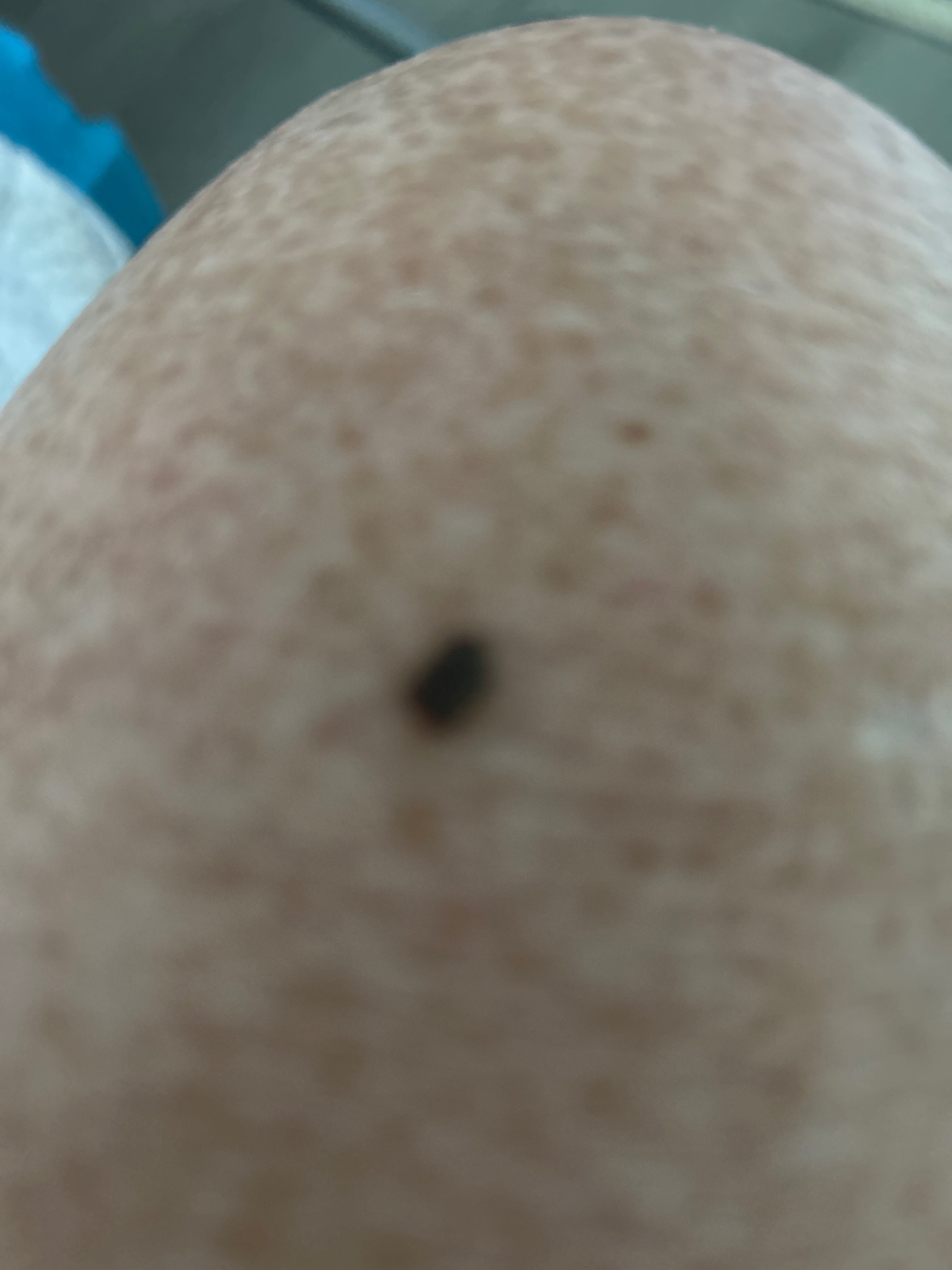 Tick