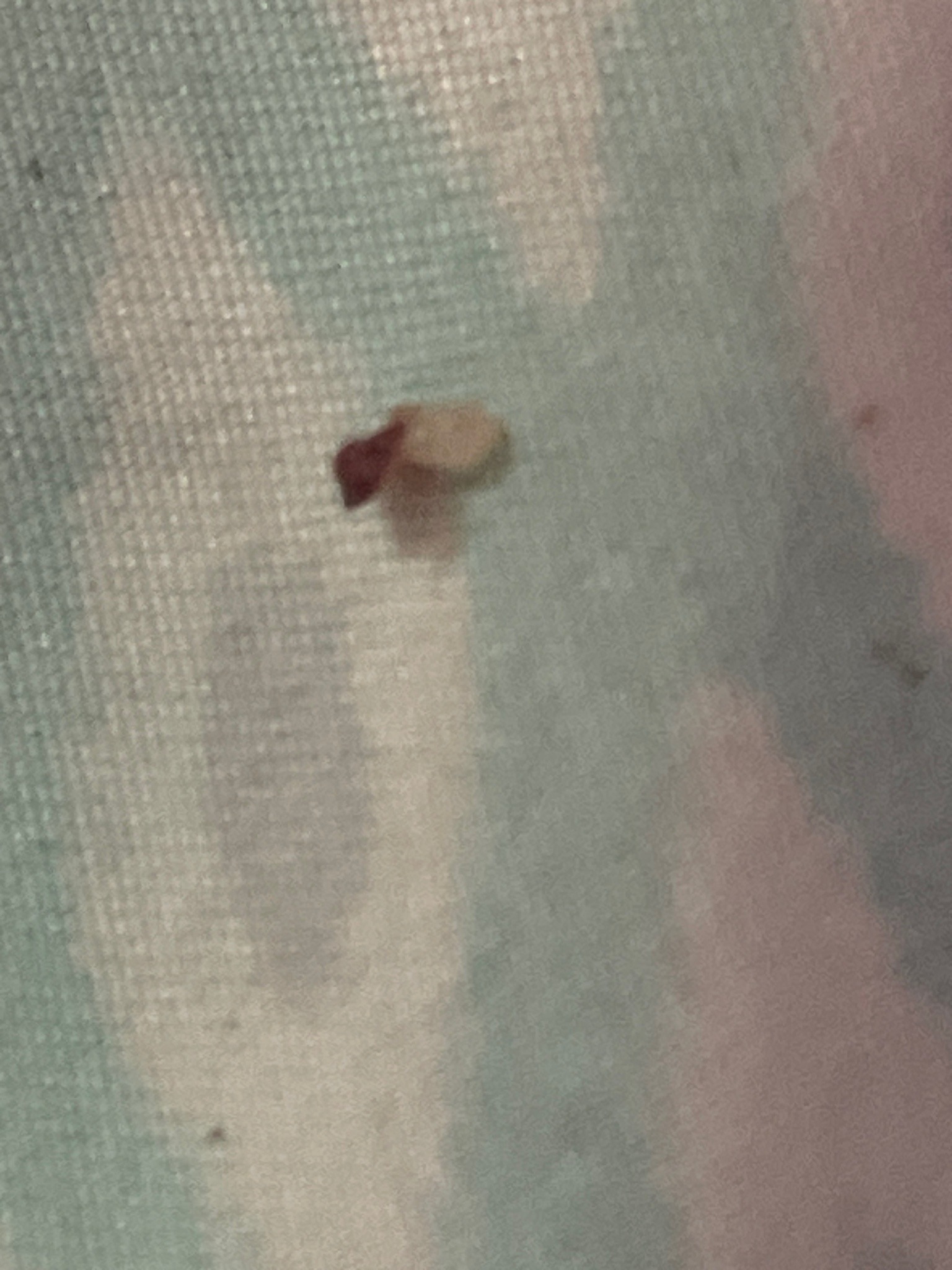 Unable to Identify
