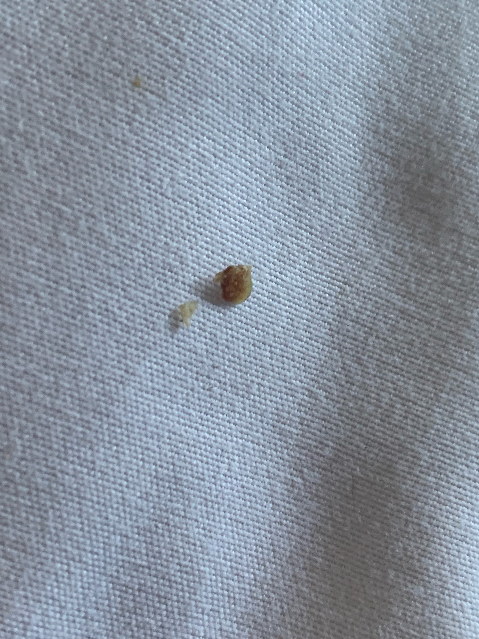 Unable to identify