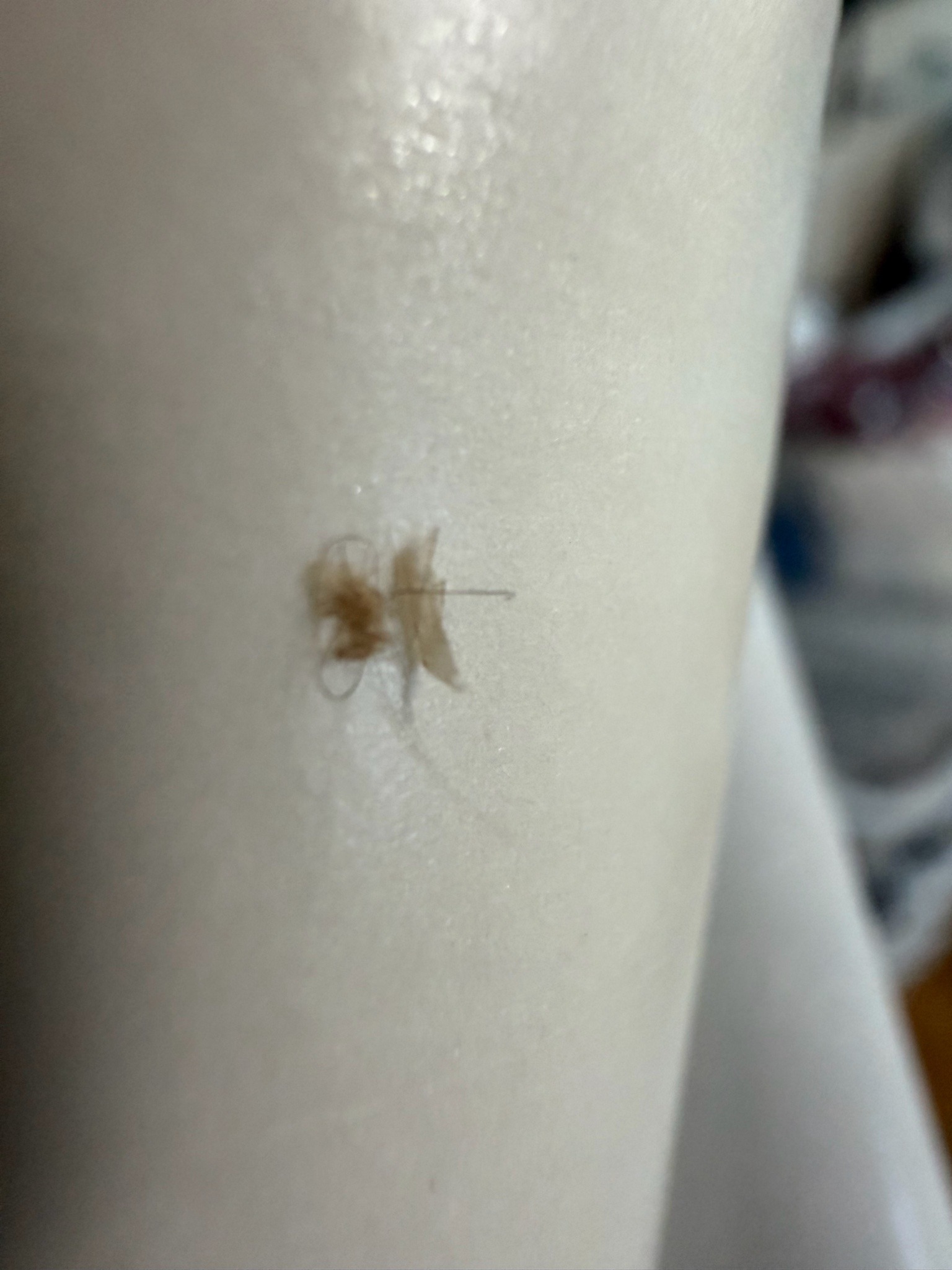 Unable to identify