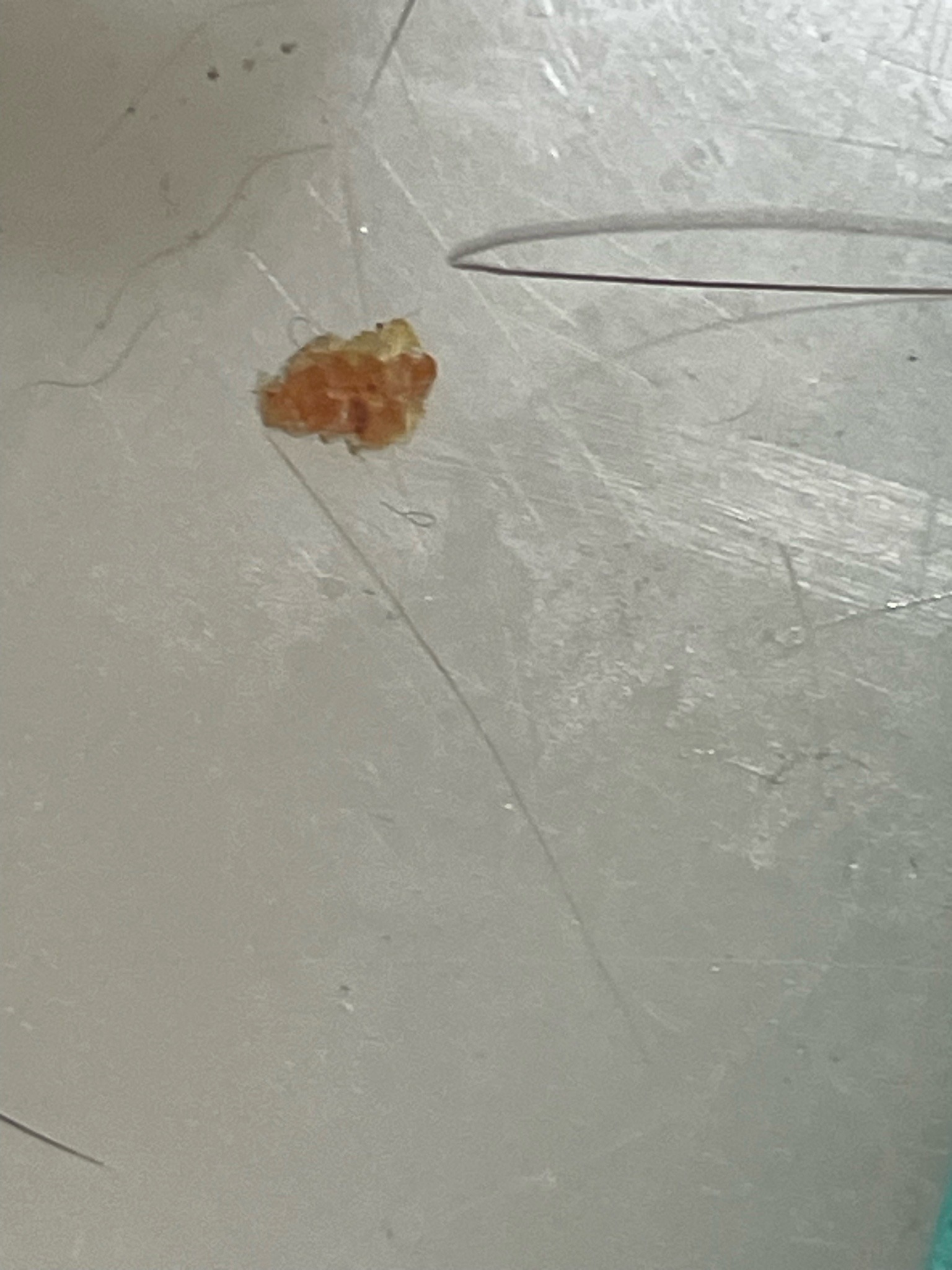 Unable to Identify