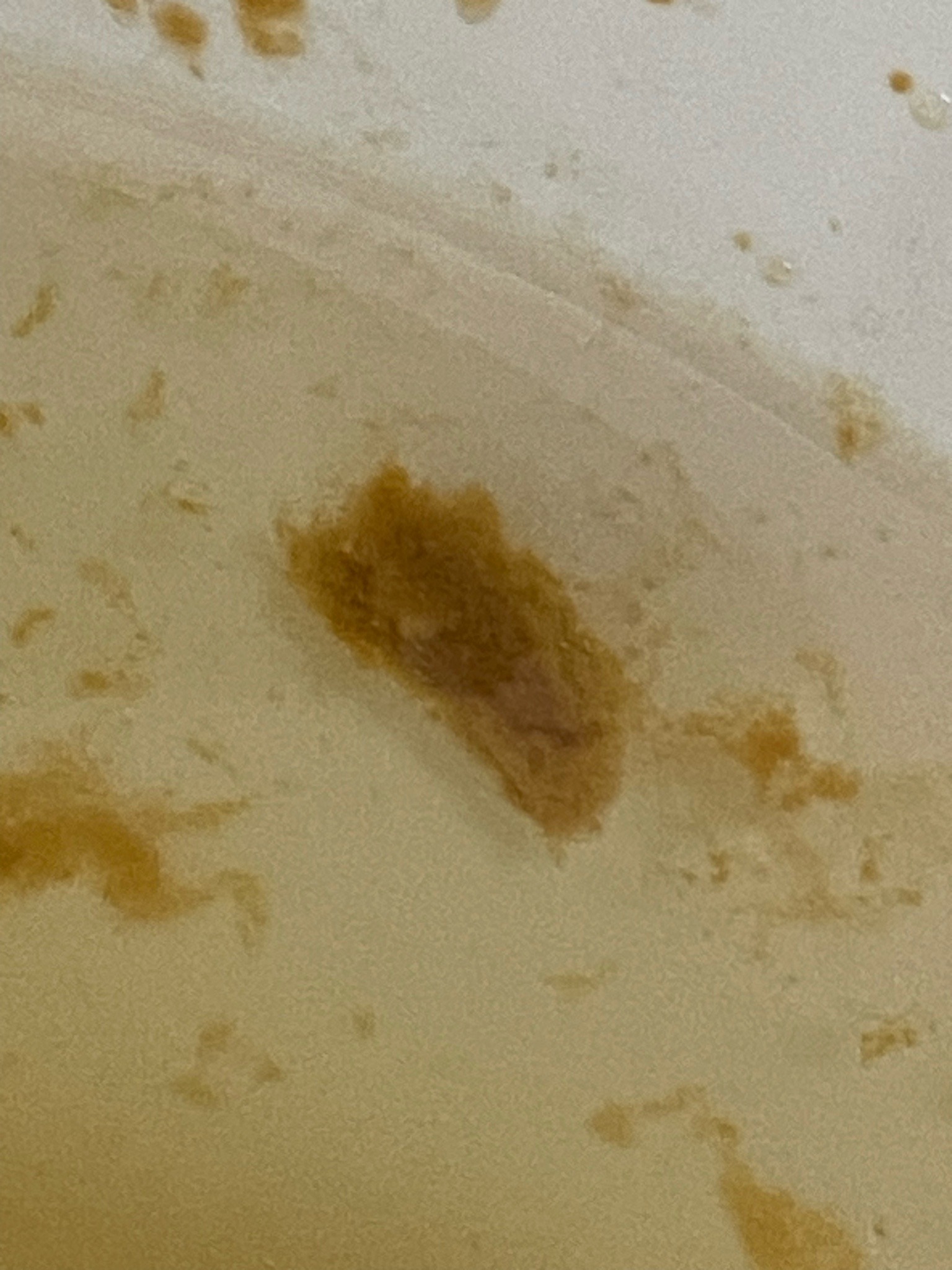 Unable to identify - Likely non-biological
