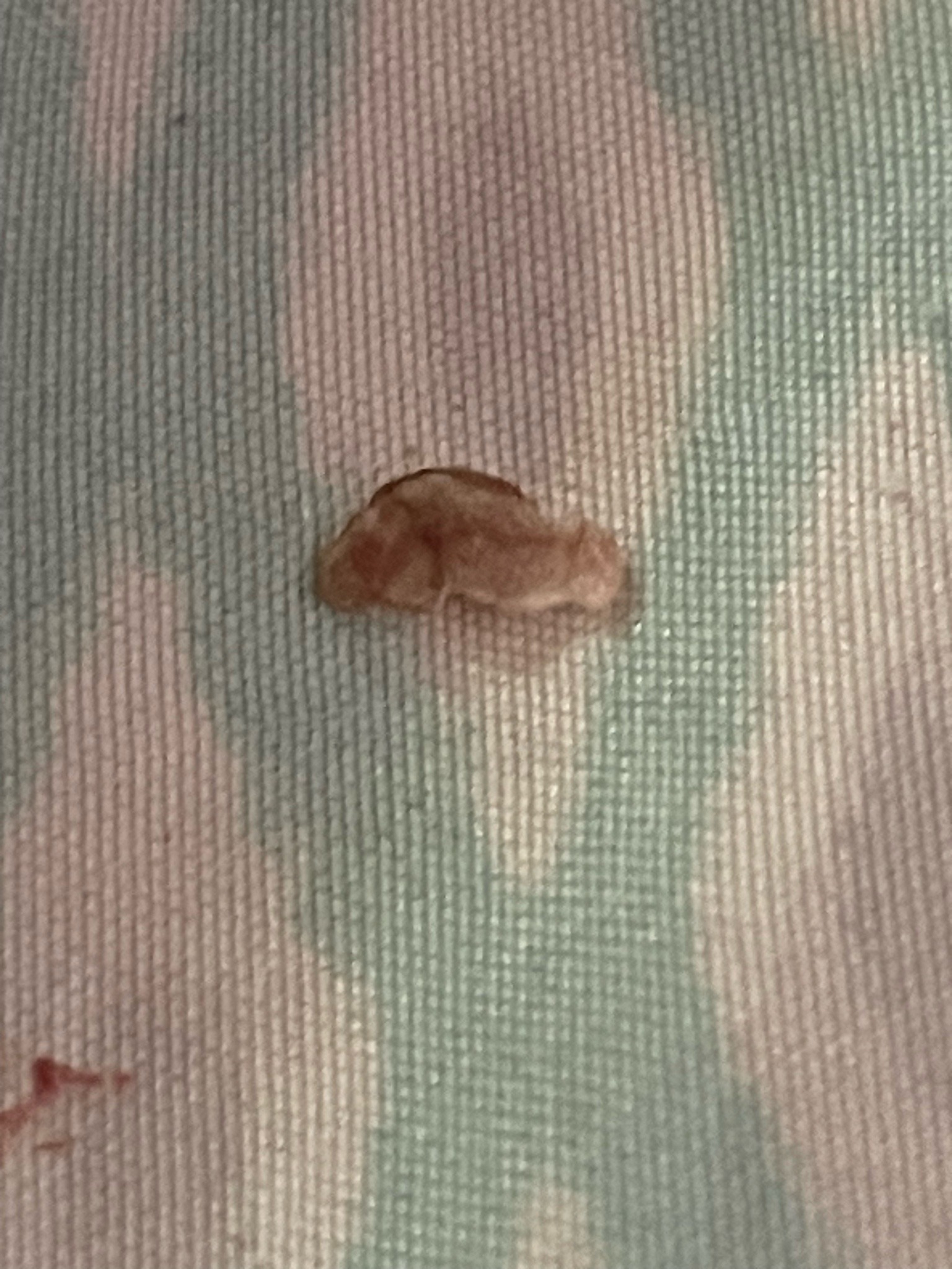 Unclear / Undetermined Specimen