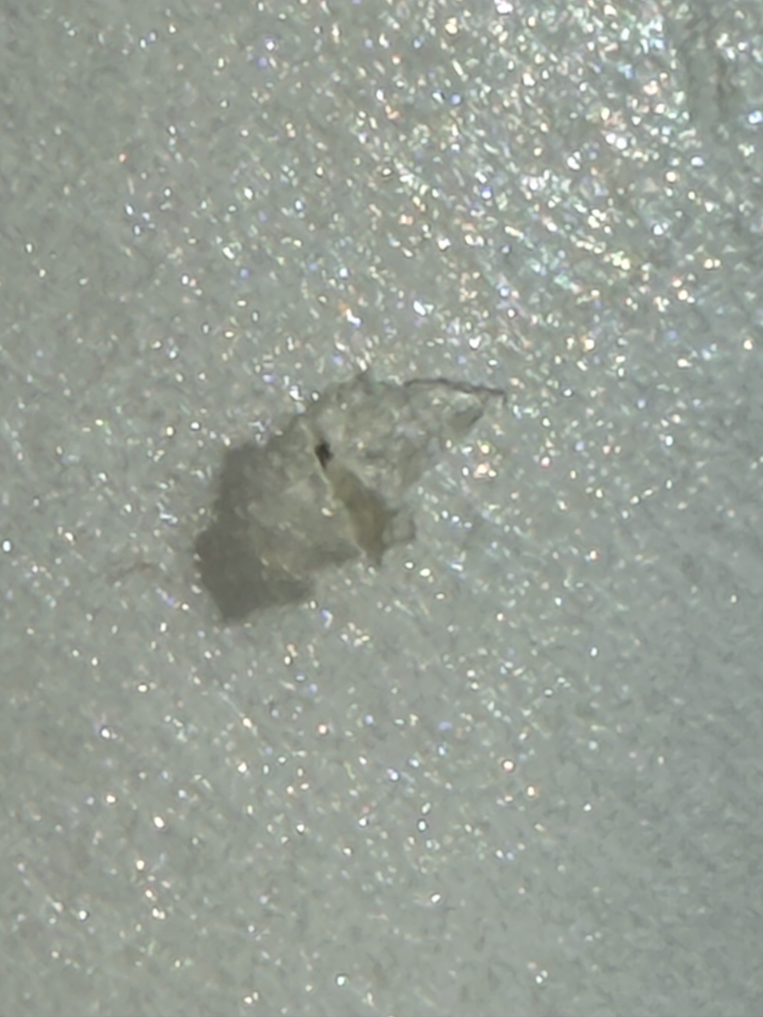 Undetermined; potentially a dust mite or skin fragment