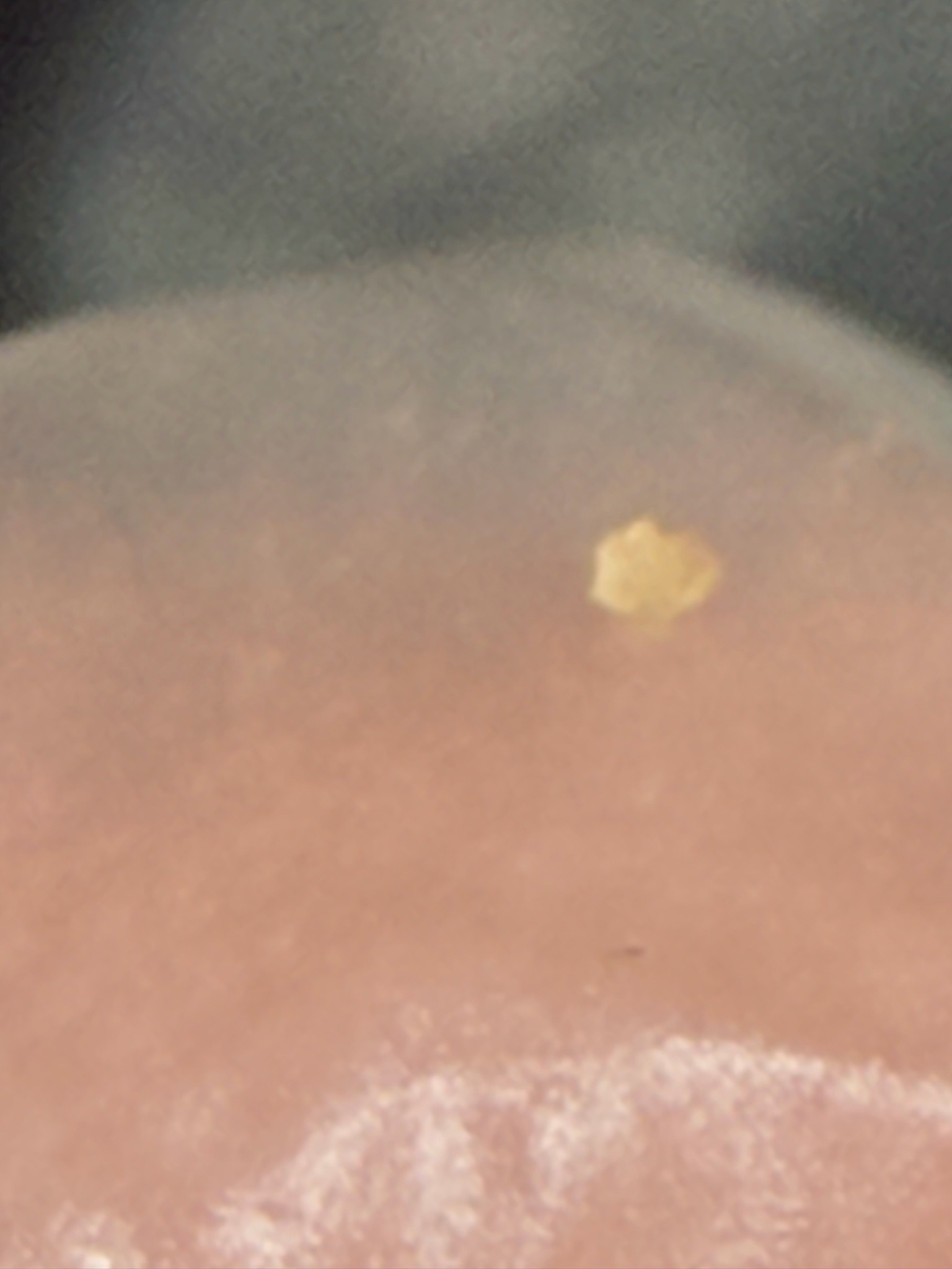 Unidentifiable from the photograph