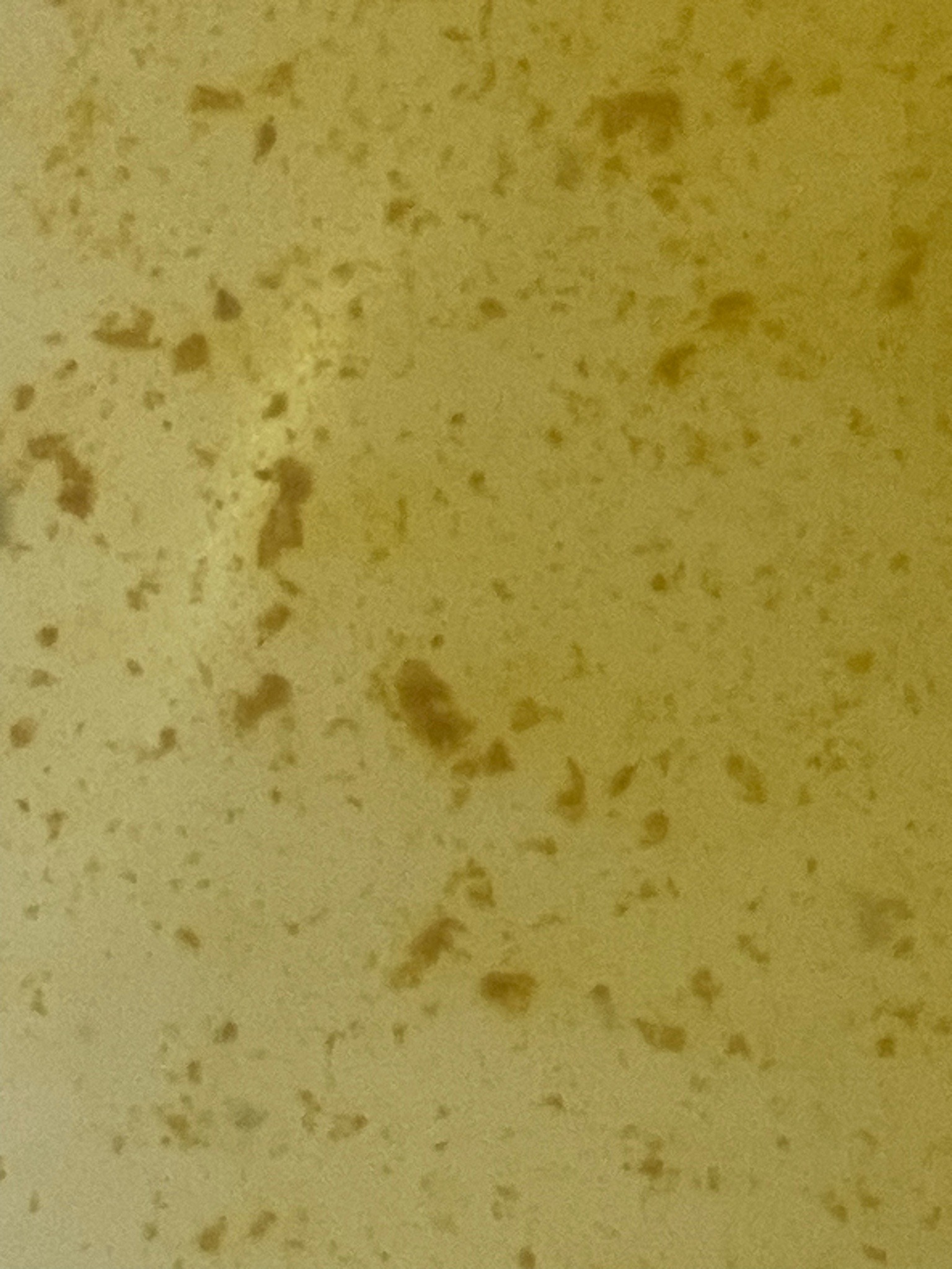 Unidentifiable (Image lacks clear subject)
