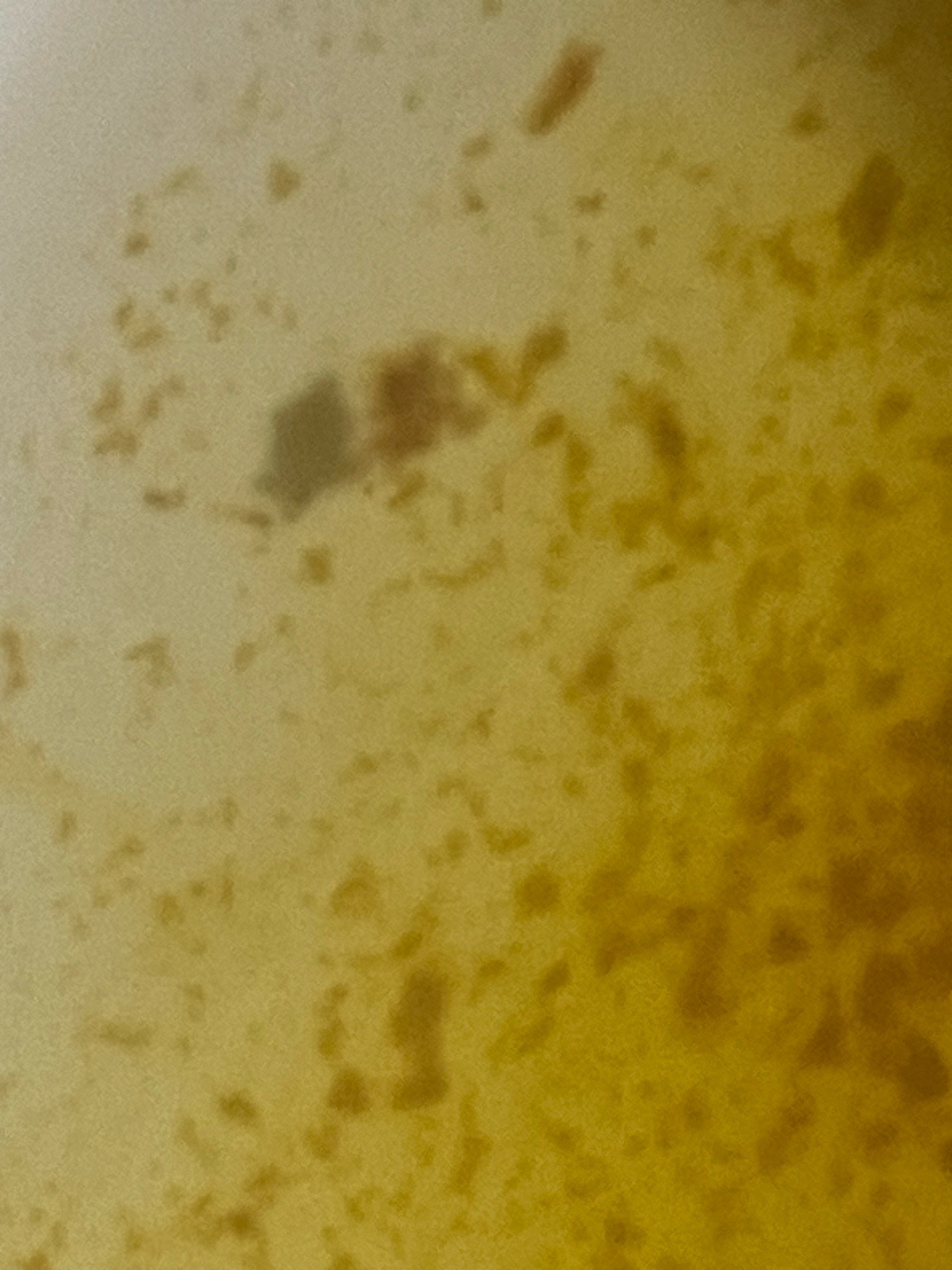 Unidentifiable Insect / Dust Debris