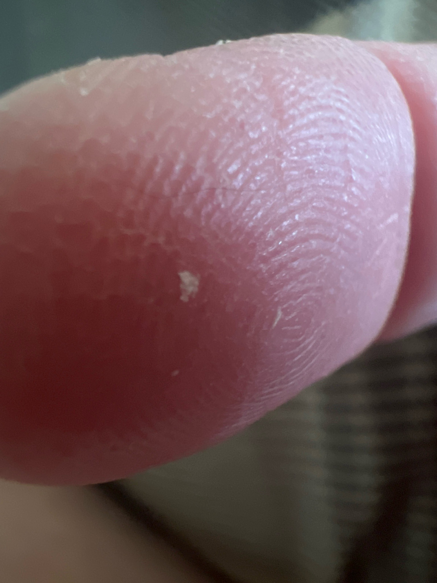 Unidentifiable; likely debris or a very small arthropod fragment
