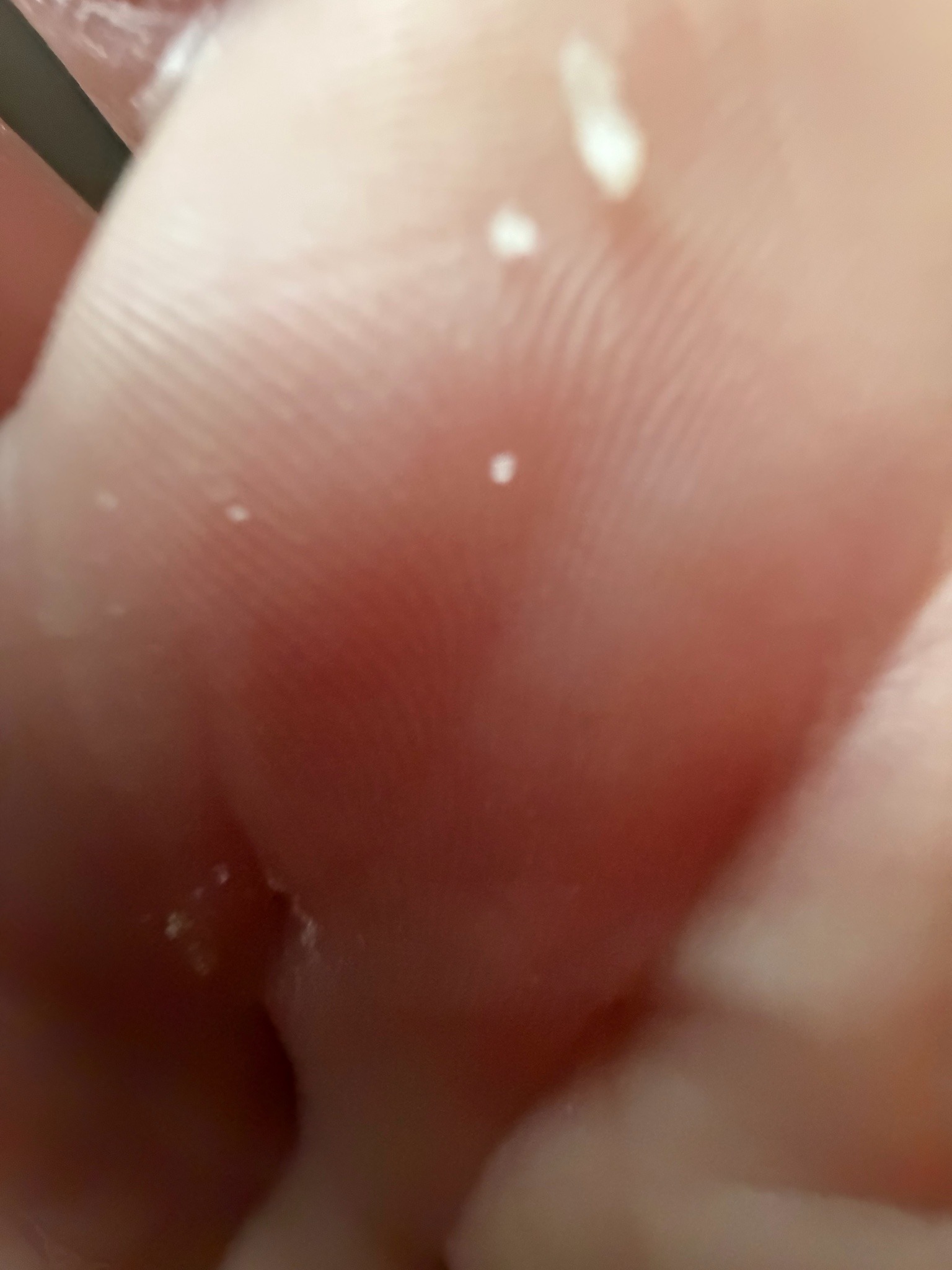 Unidentifiable; likely debris or a very small pale mite