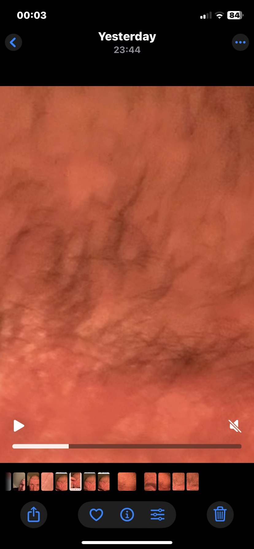 Unidentifiable (No insect present)