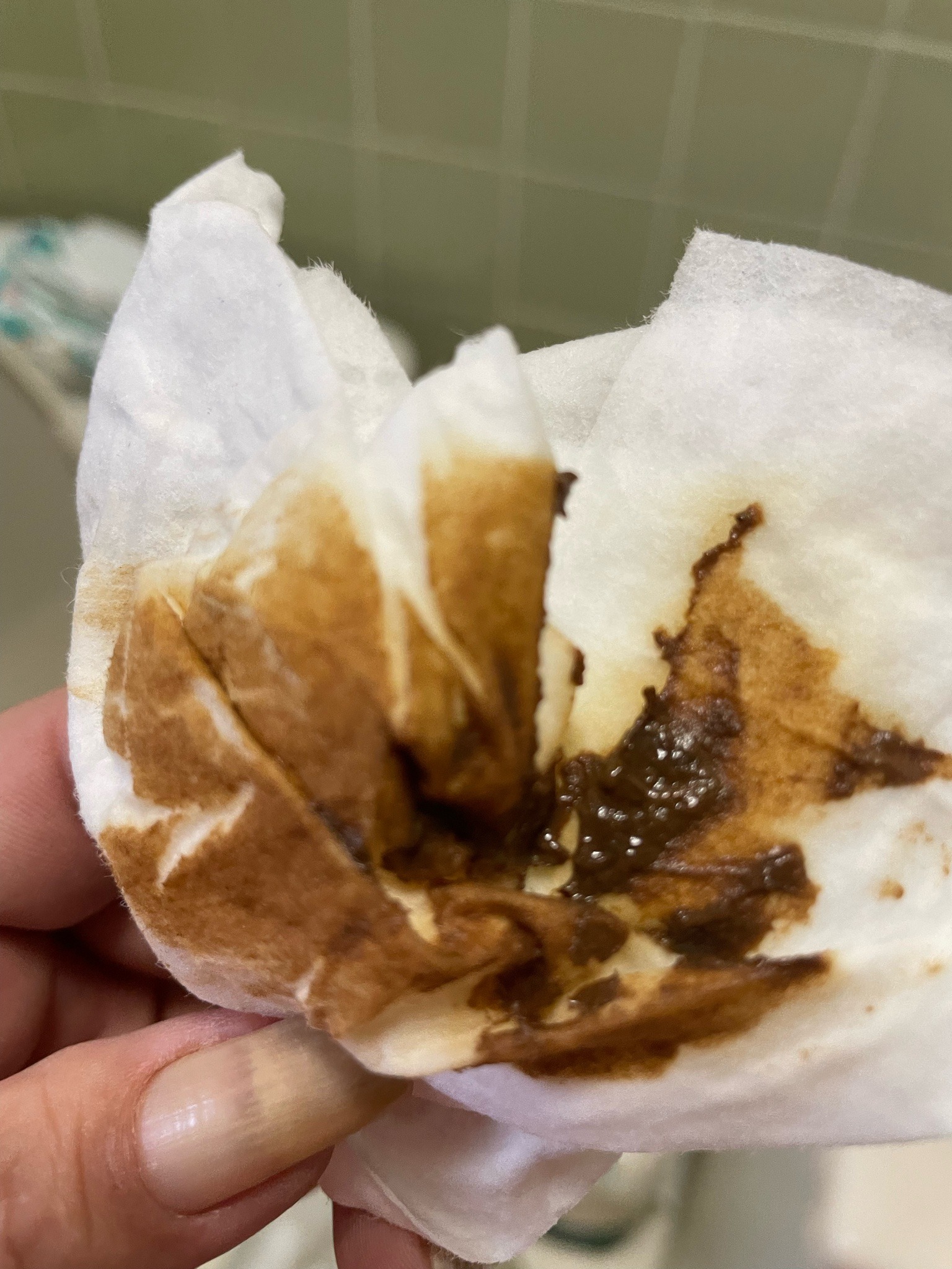 Unidentifiable (Non-insect substance / Smears on tissue)
