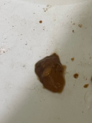 Unidentifiable Object / Non-insect material