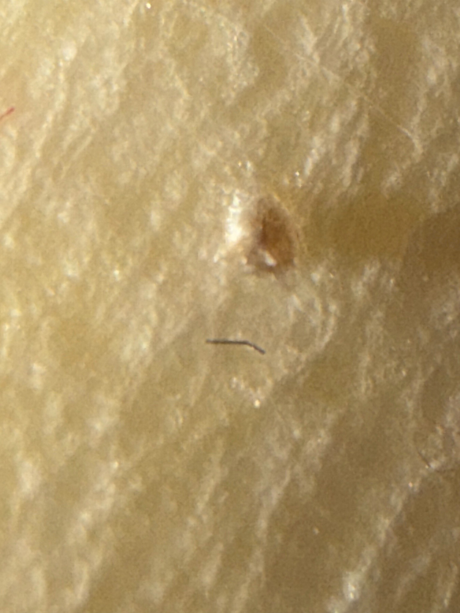 Unidentifiable Object / Non-Insect Debris