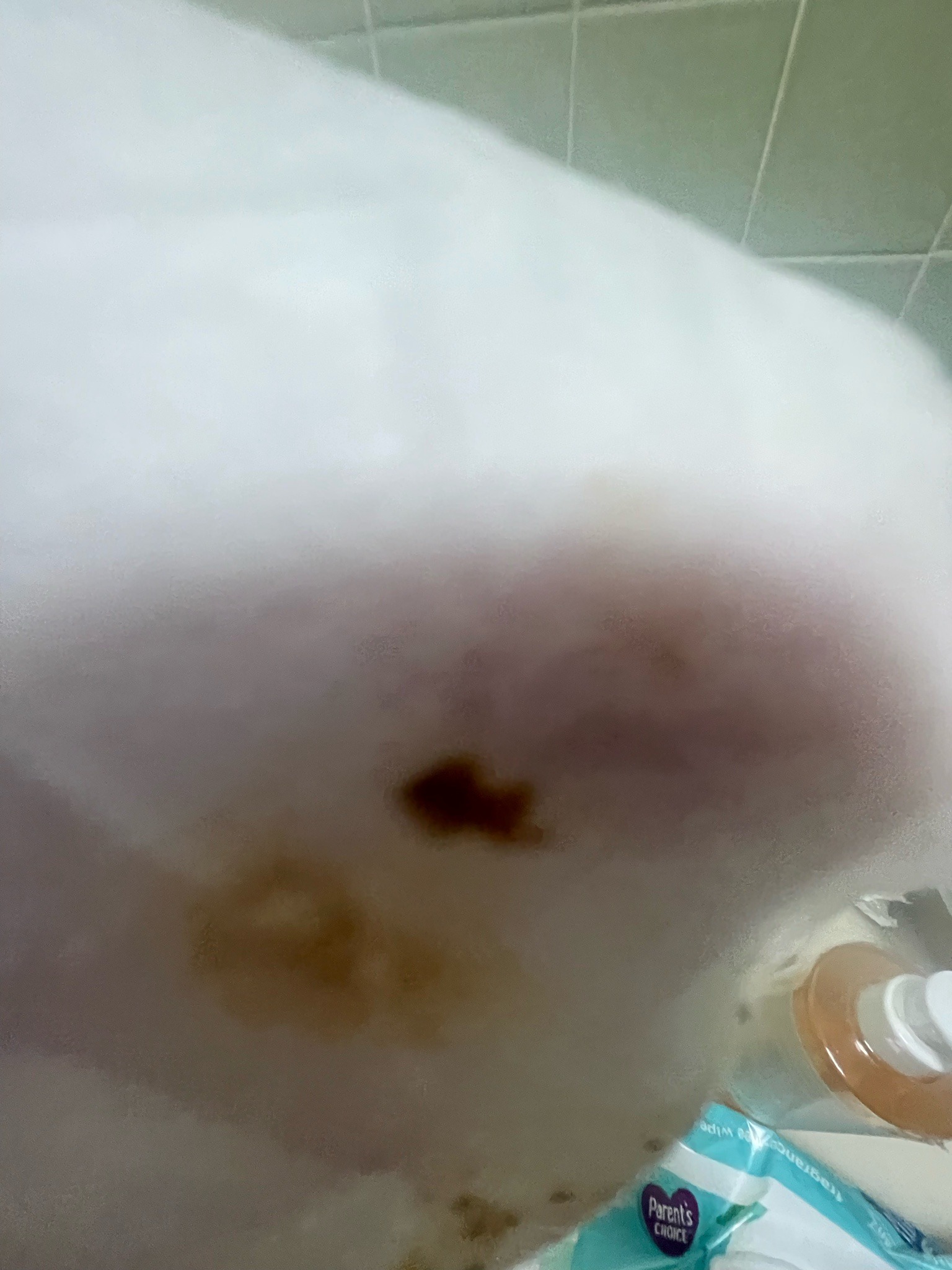 Unidentifiable specimen due to image quality